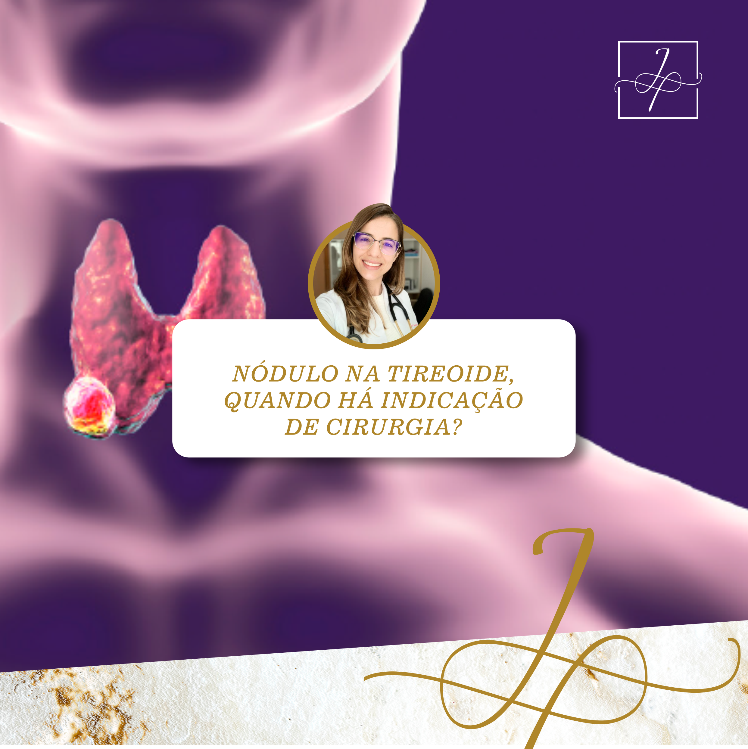 Nódulo da tireoide e indicação de cirurgia