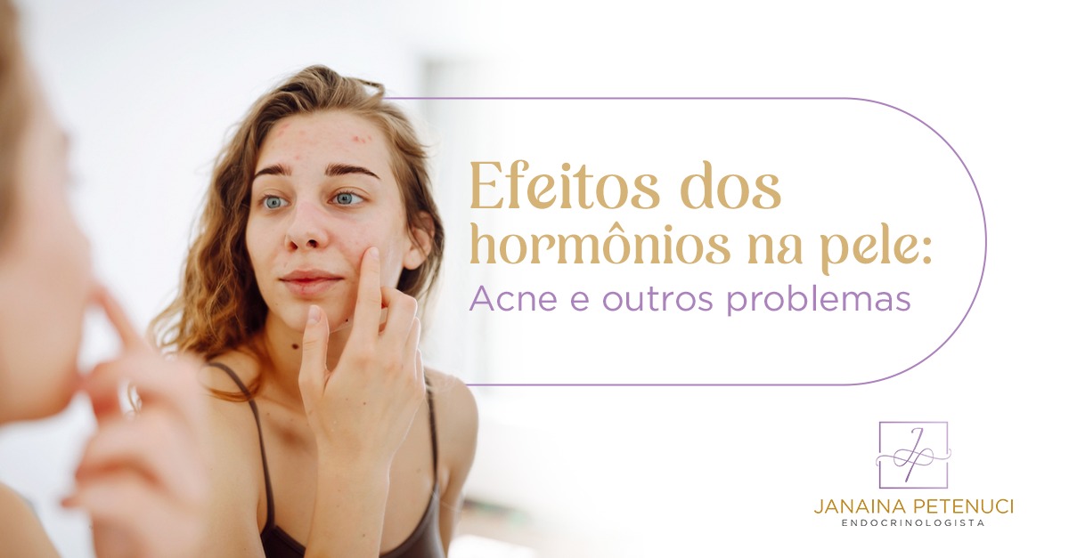 Efeitos dos Hormônios na Pele: Acne e Outros Problemas