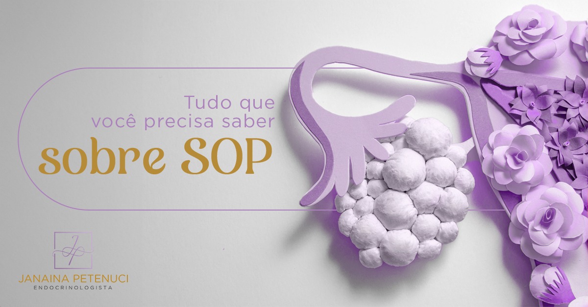 Tudo que você precisa saber sobre SOP